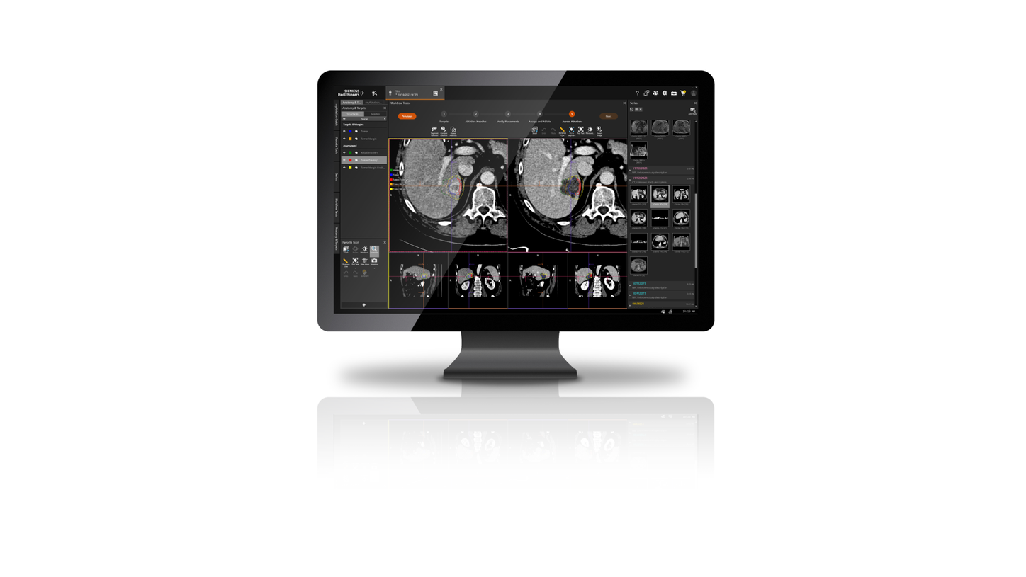myAblation Guide Ablation Confirmation Software