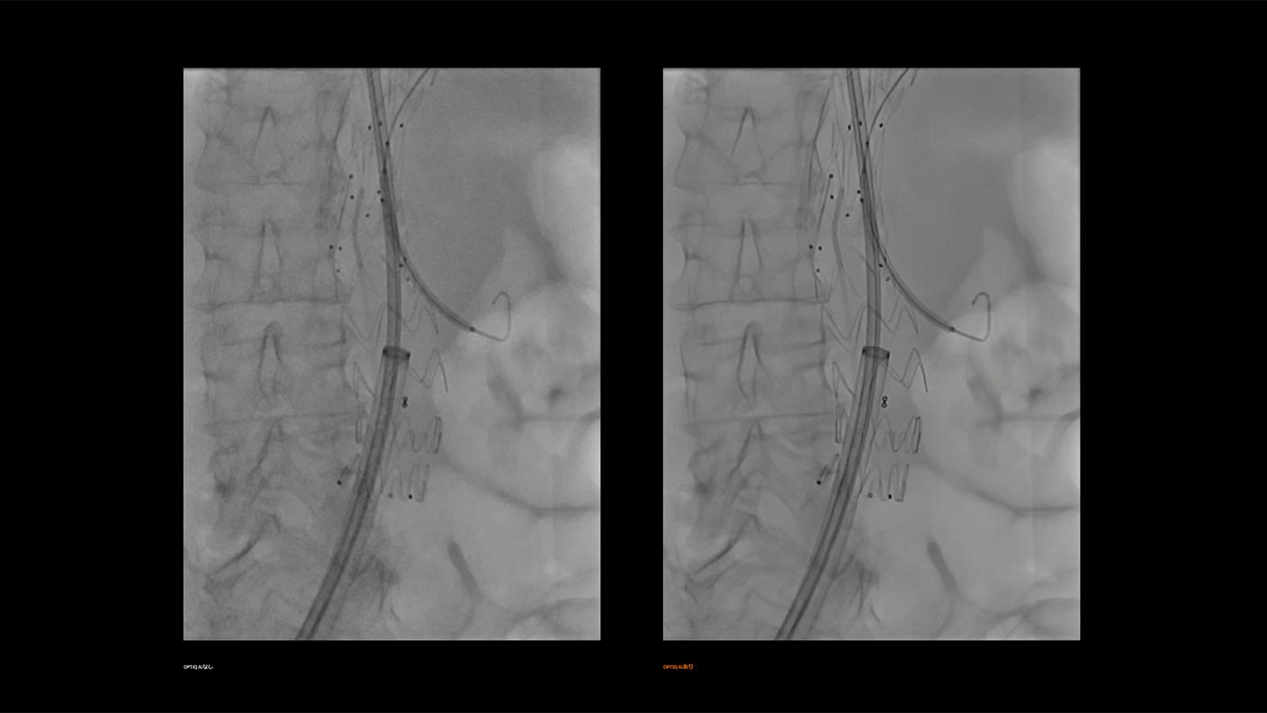 PR:ARTIS pheno.vision OPTIQありとなし比較