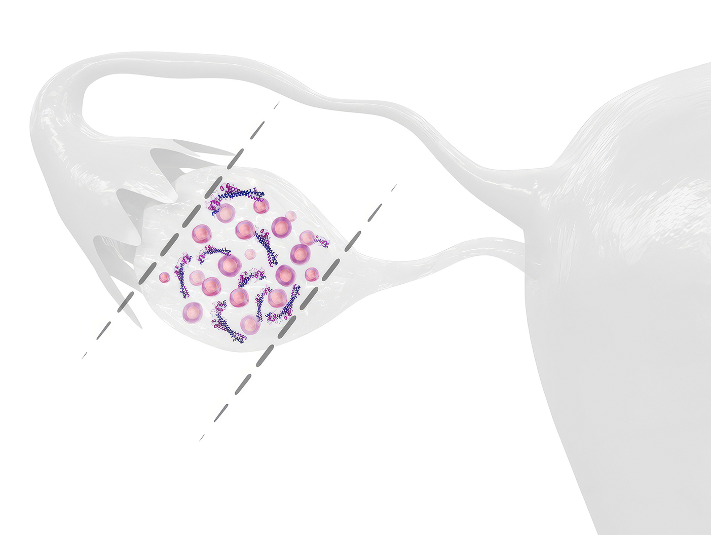 Expanded utility for AMH testing in fertility supports assessment of treatment response