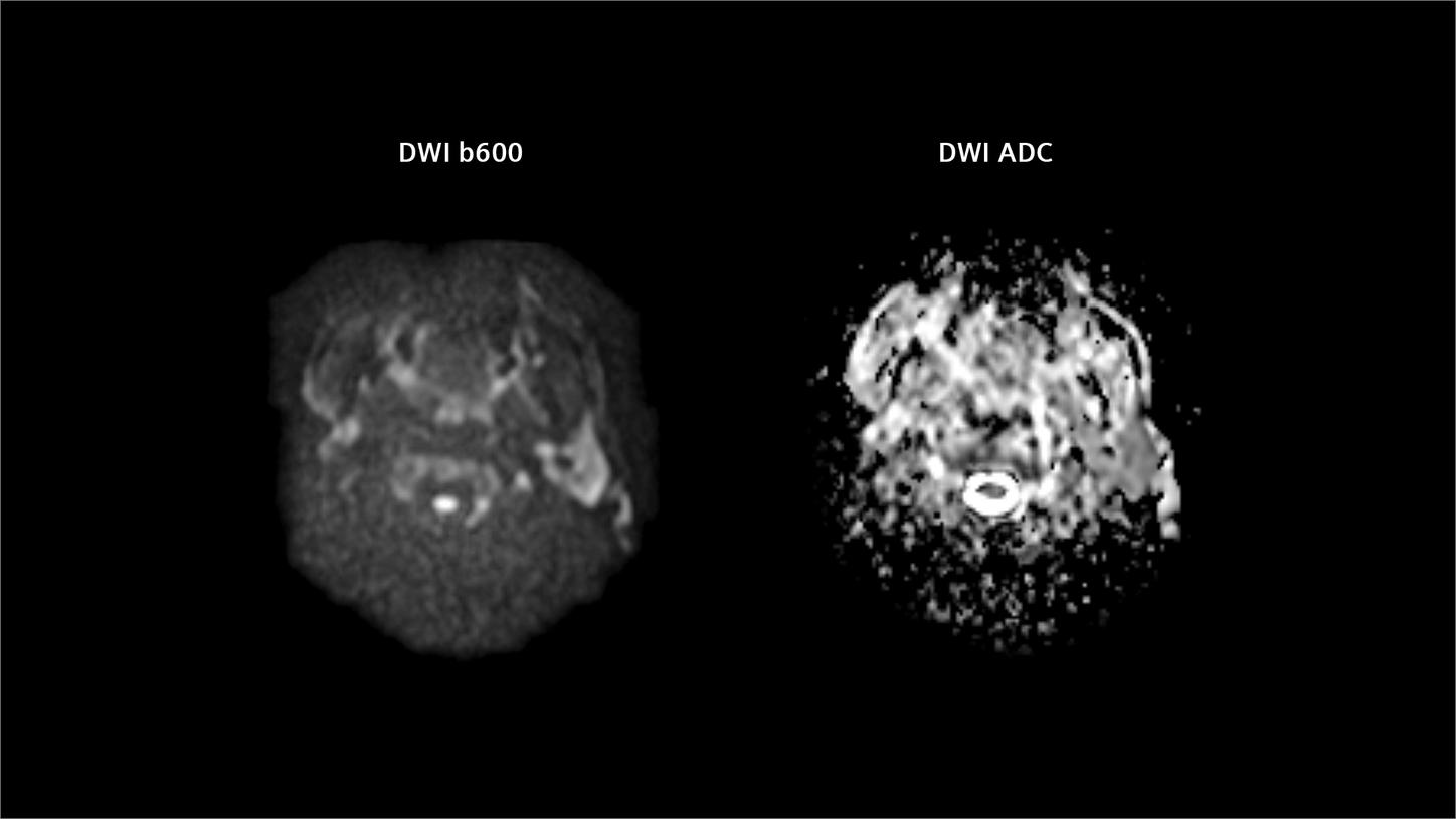 Functional imaging provides critical biological insights for RT planning