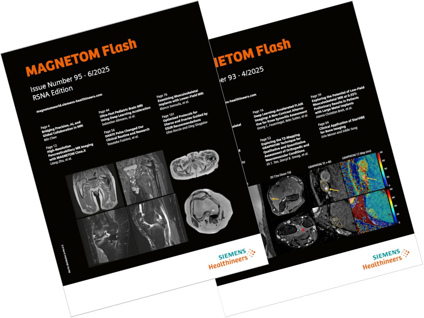 MAGNETOM Flash<br /><br />