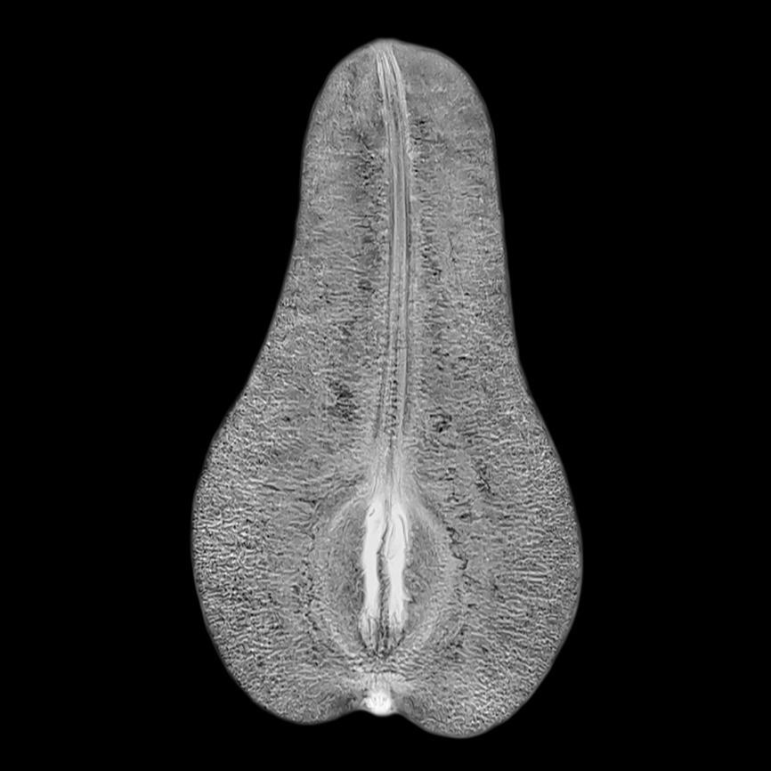 Siemens-healthineers_Magnetomworld_Pear_CimaX