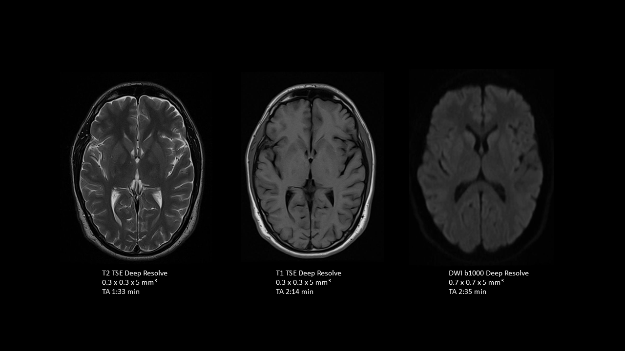 T1, T2, and DWI imaging for transversal brain assessment 
