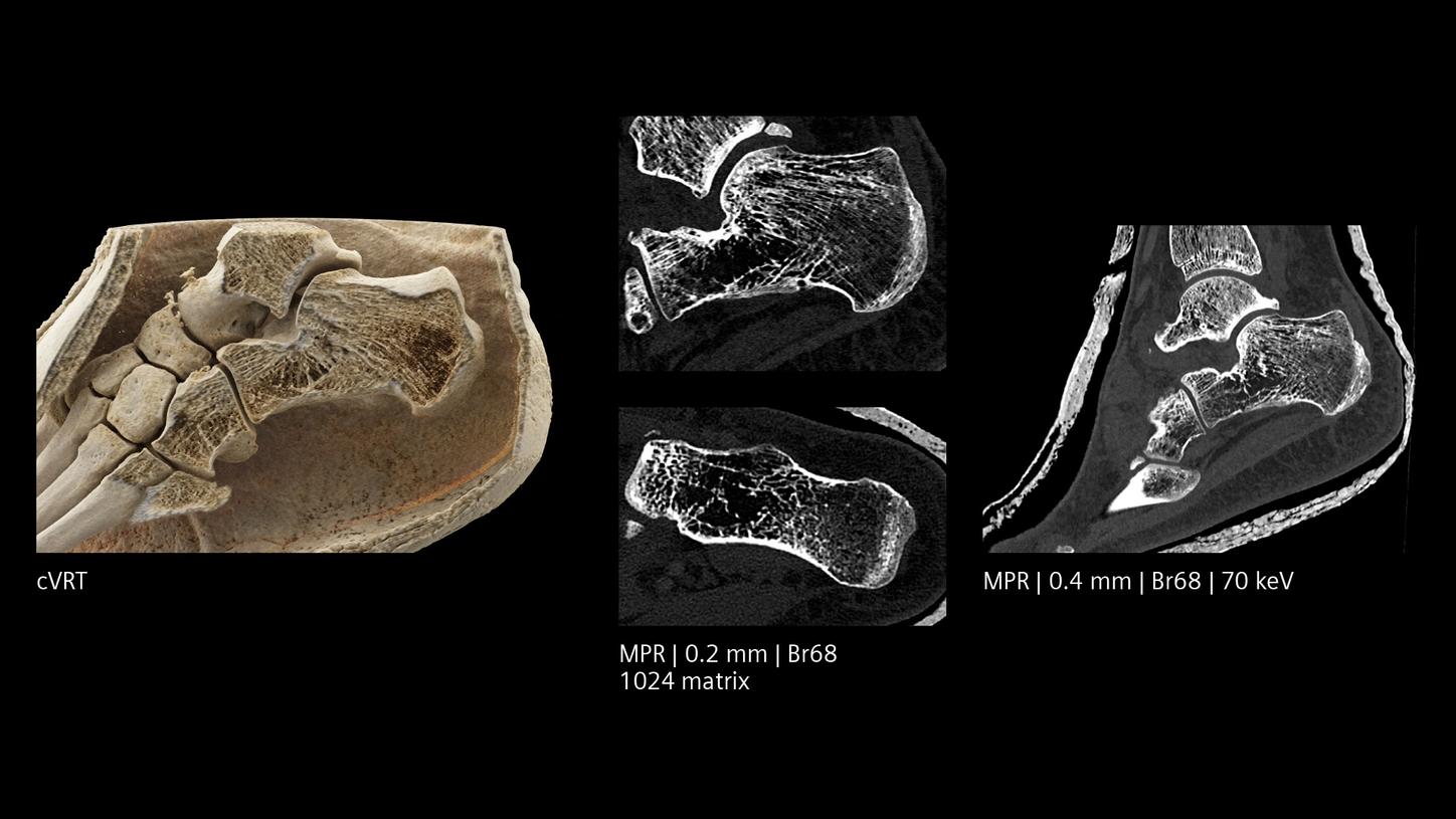 Follow-up scan in cast after trauma 