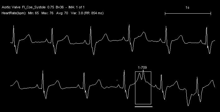 The spectrum of Cardiothoracic CT imaging_Case_1
