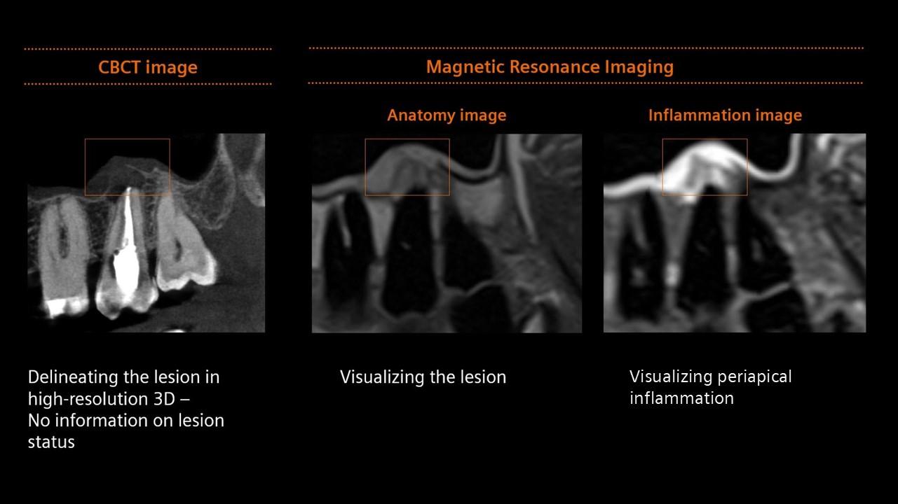 clinical image