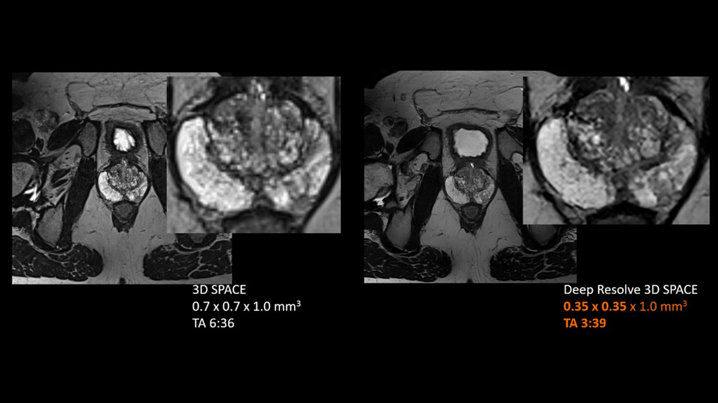 Deep Resolve 3D SPACE