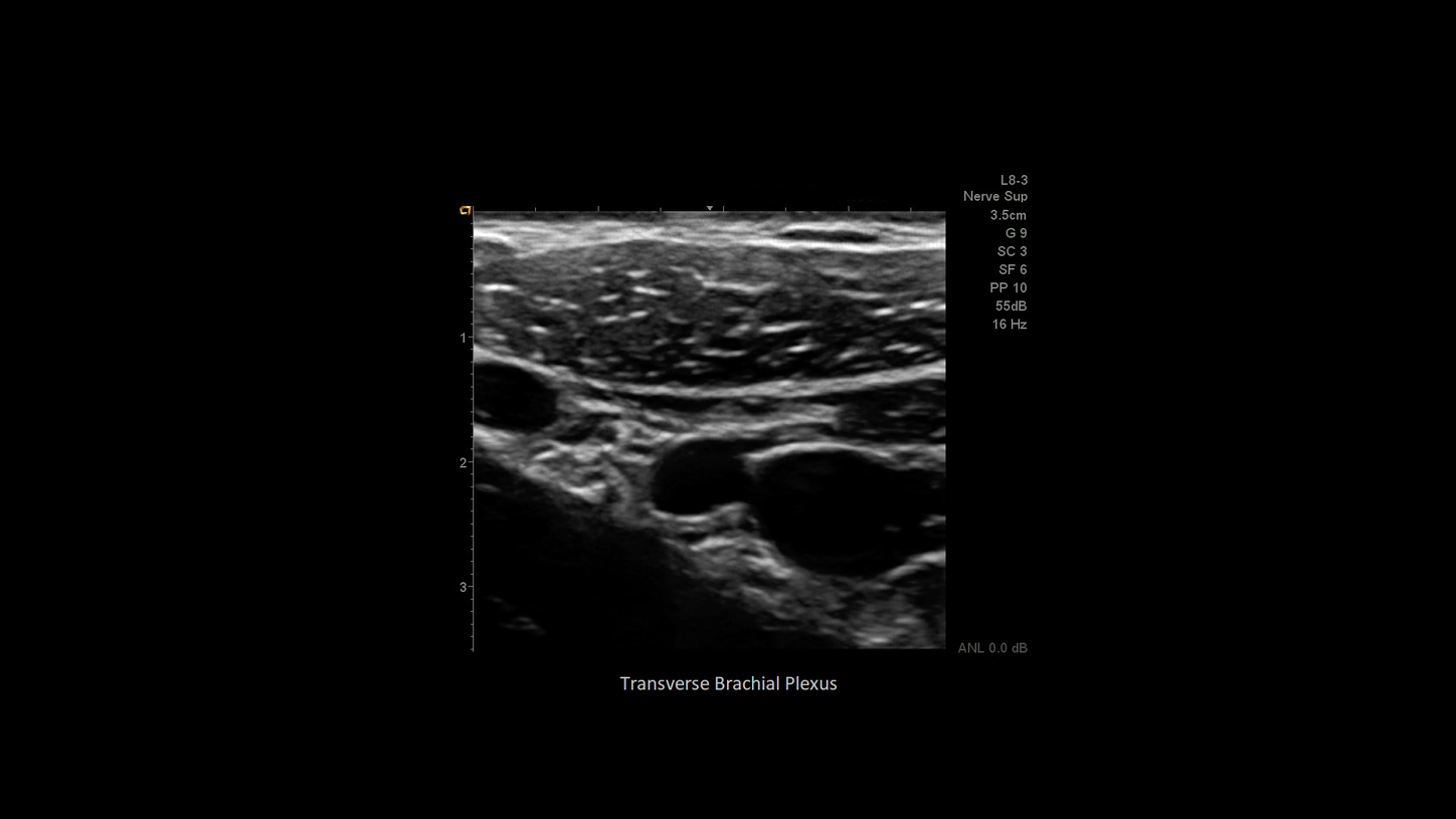 Musculoskeletal, freestyle