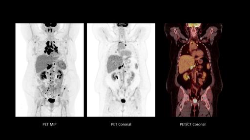 Biograph Trinion PET/CT scanner - Siemens Healthineers Japan
