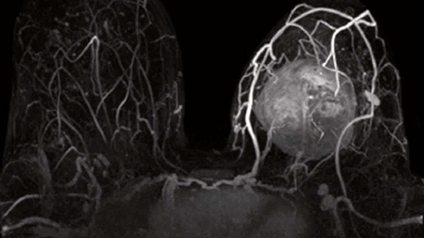 MR – Breast Workshop