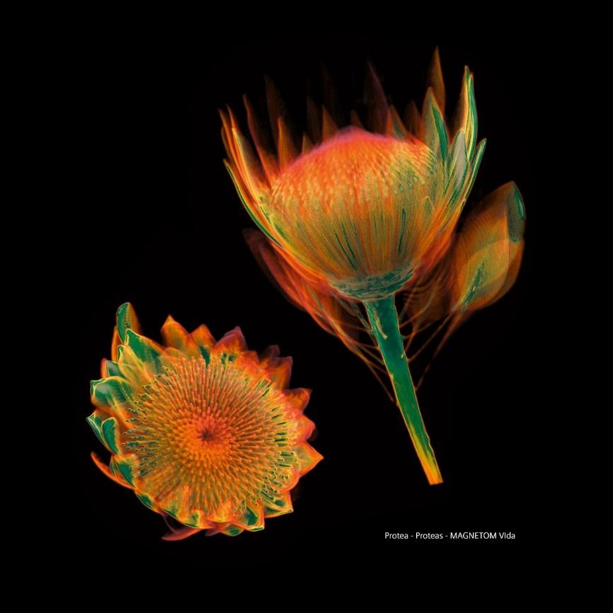 Siemens-healthineers_Magnetomworld_Proteas_Vida