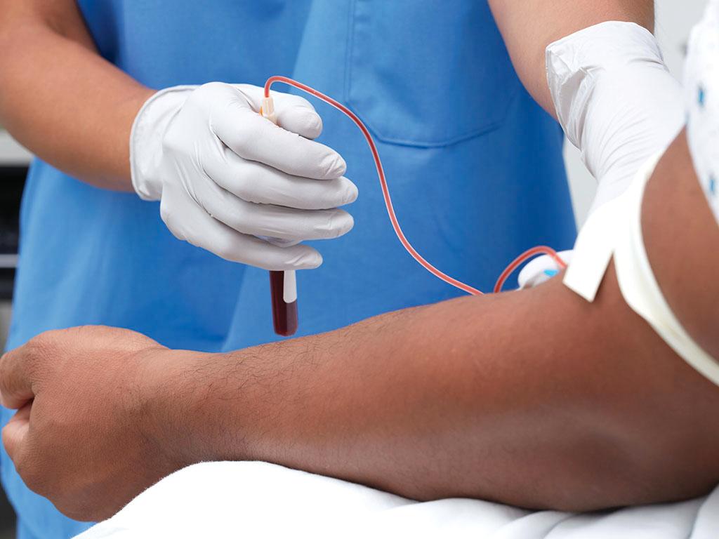 The Enhanced Liver Fibrosis (ELF) Test as a Prognostic Tool