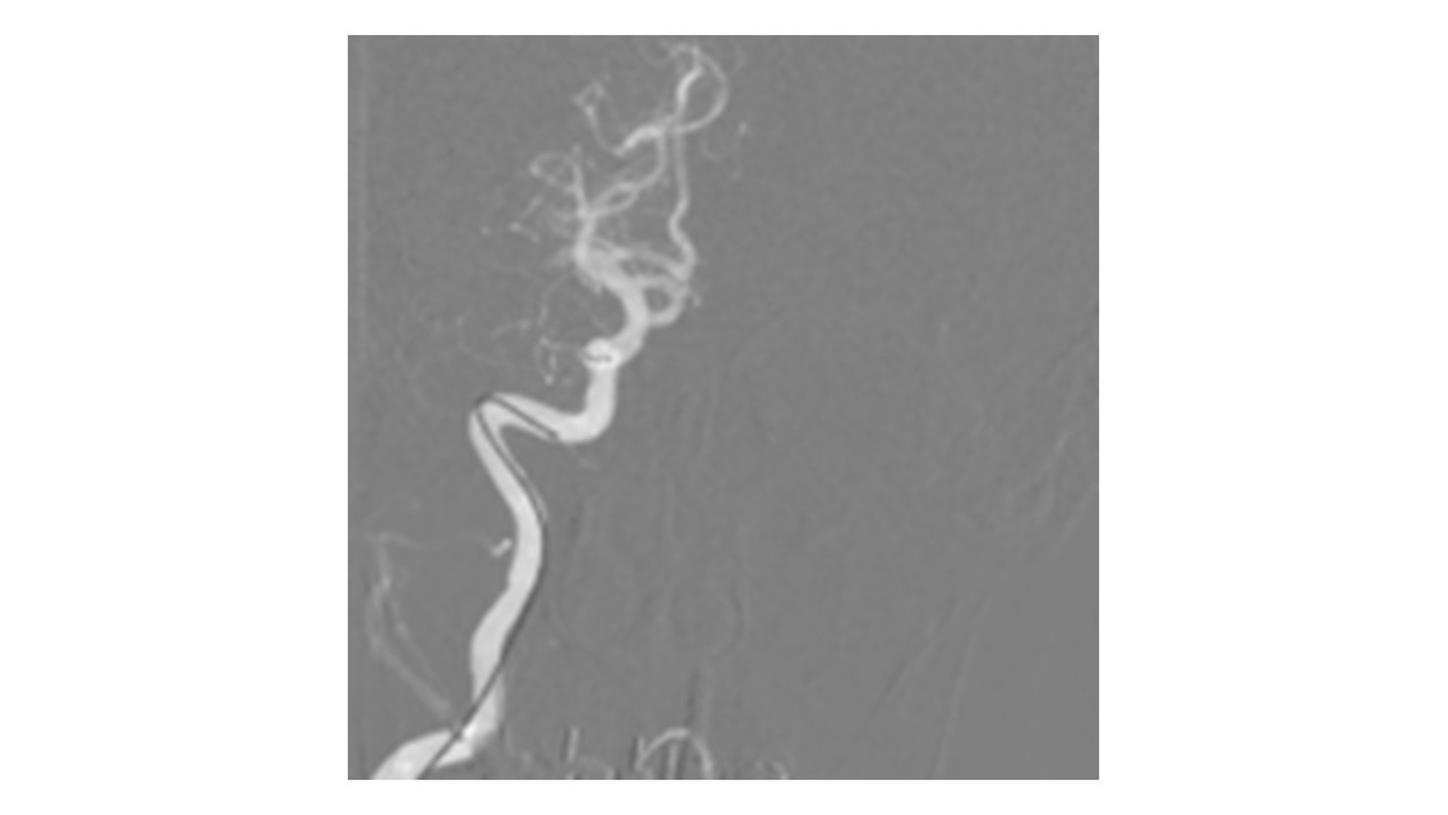 OPTIQ AI Roadmap image