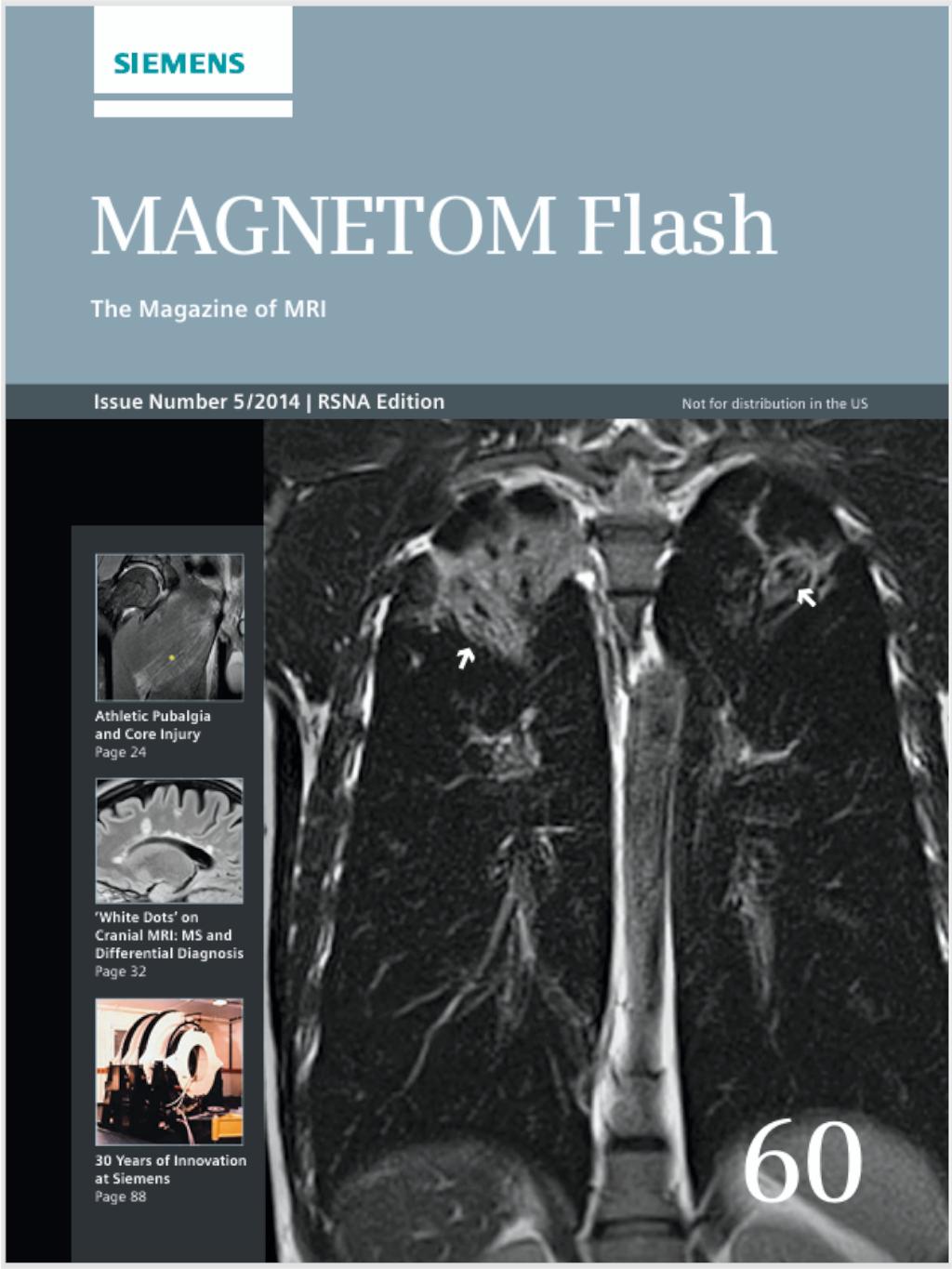 magnetom-flash_60_2014