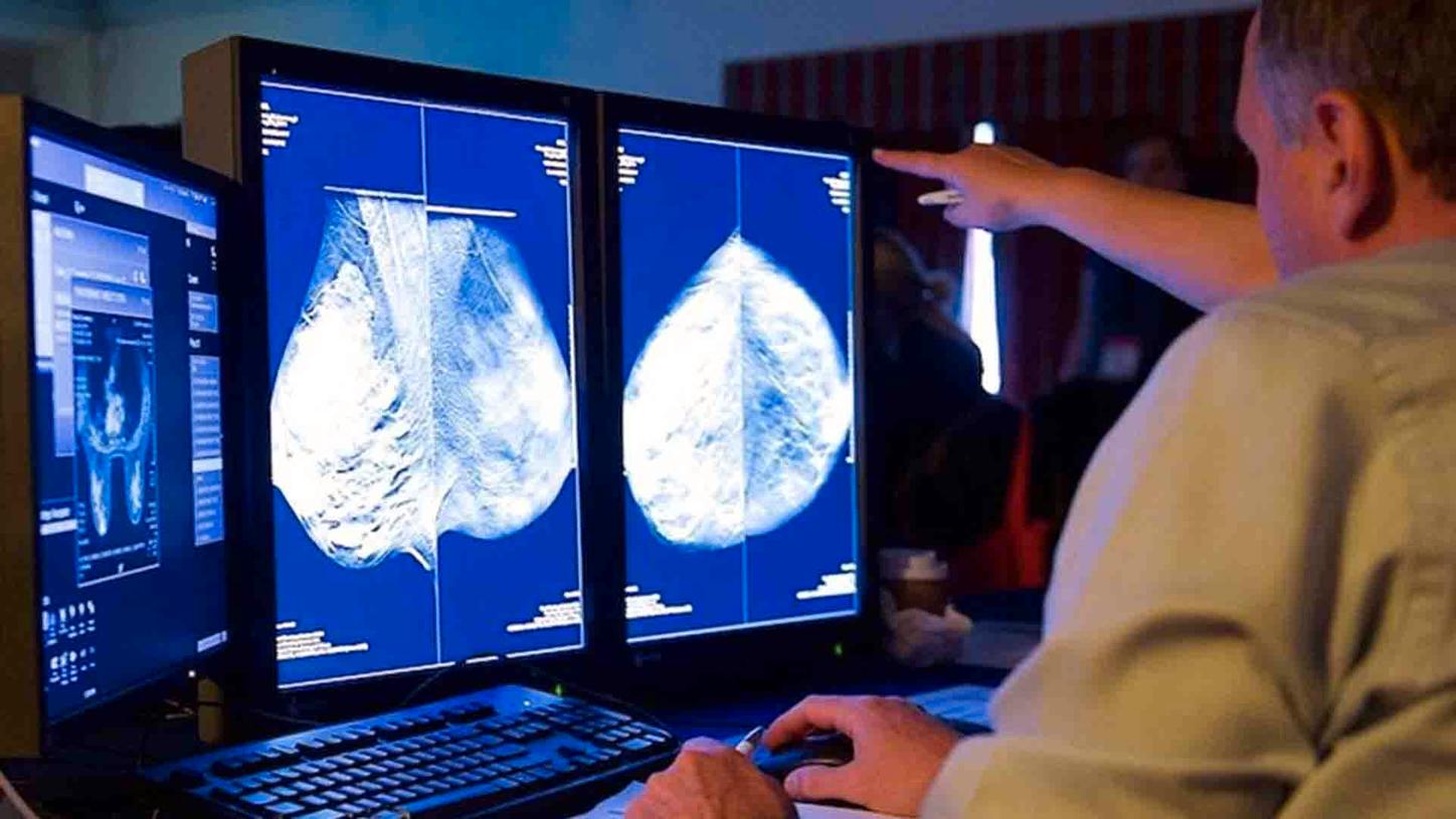 Advances in Breast Imaging