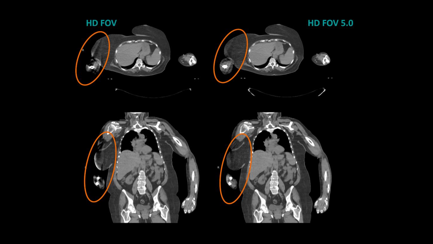 Teaser Image for HD FOV 5.0