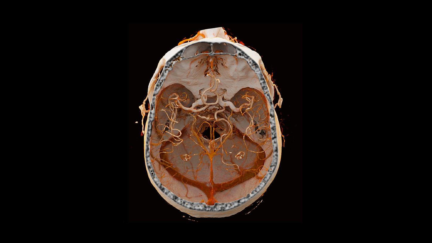img prod serv neurologia