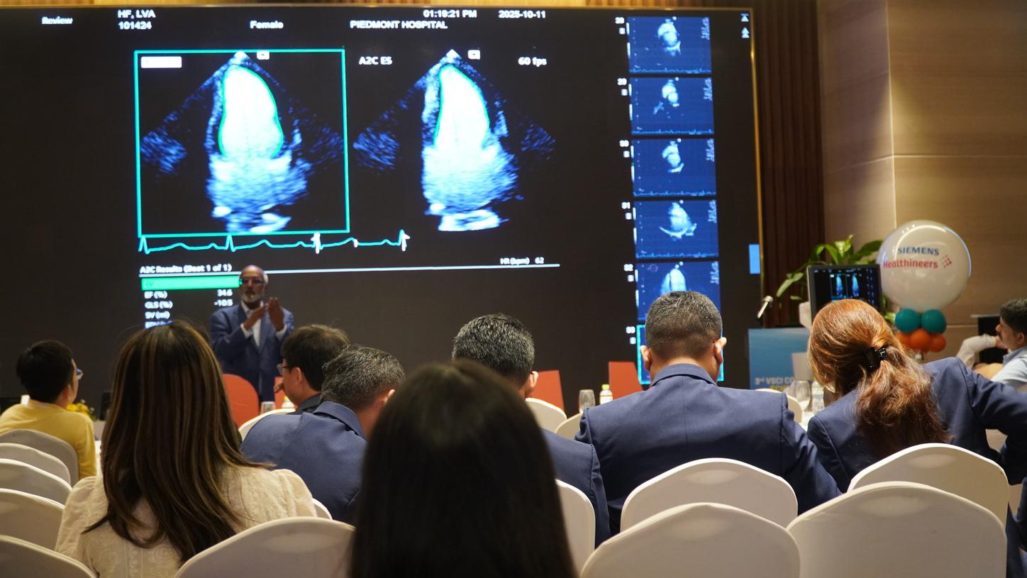 Lunch Symposium on “AI and Recent Advancement in Echo”