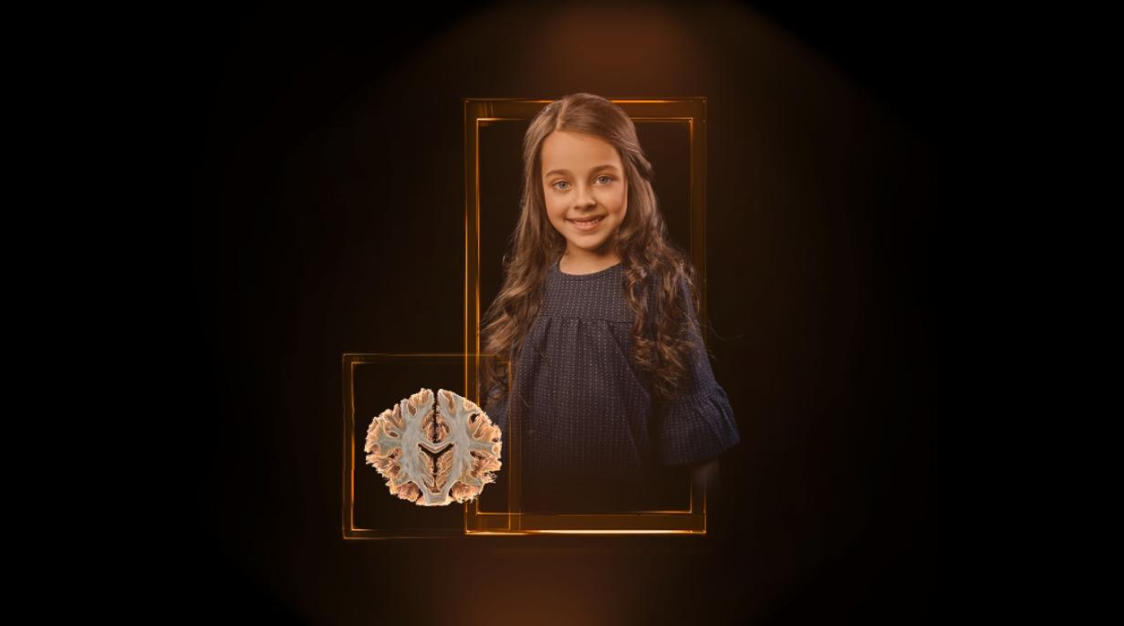 Neurology Imaging Gallery