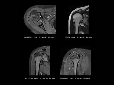 QED Shoulder Clinical Images