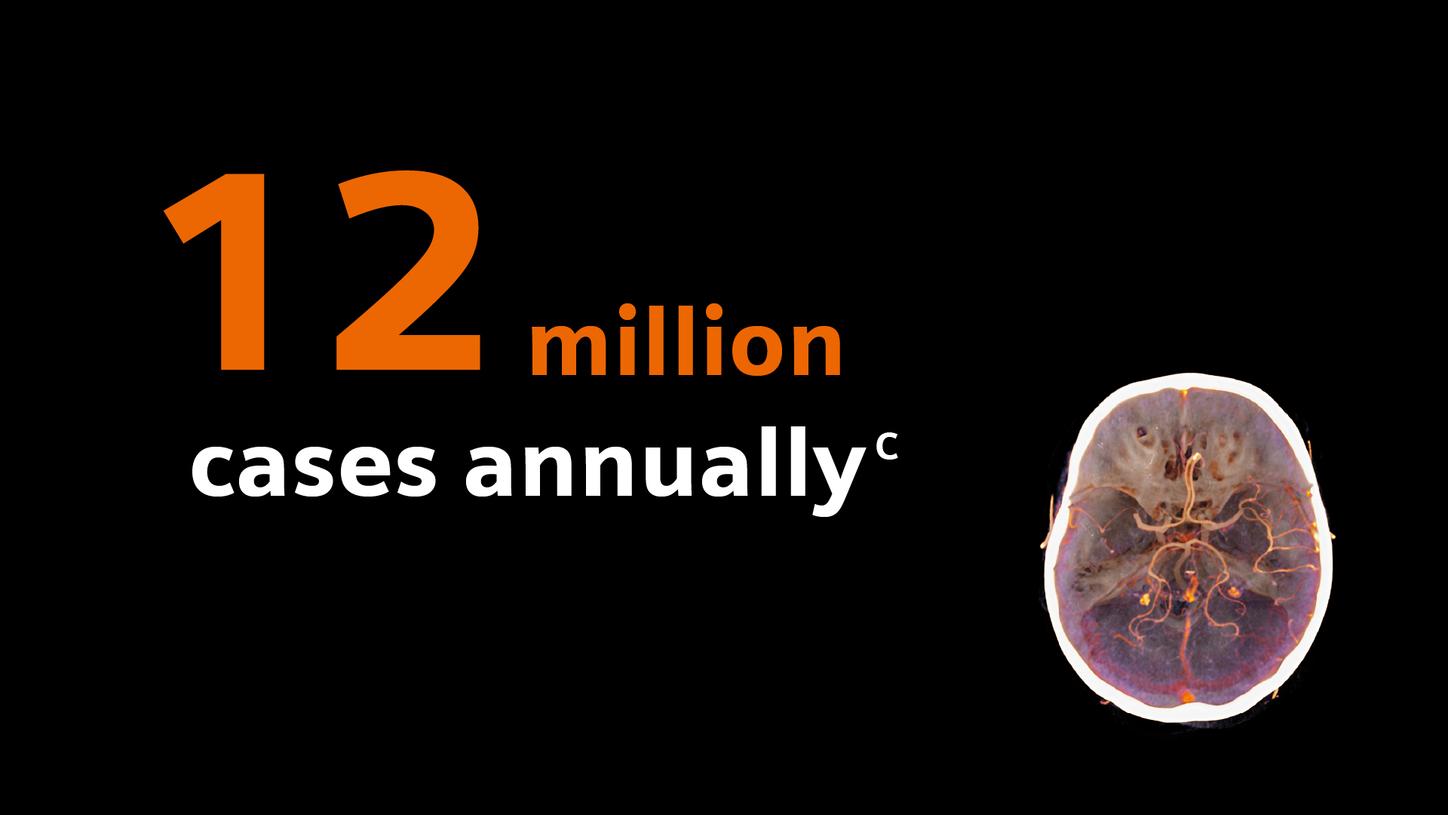 Infographic reading “12 million cases annually” with a brain scan image.