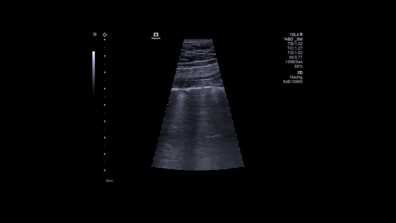 White Paper: Lung Ultrasound in Patients with Coronavirus COVID-19