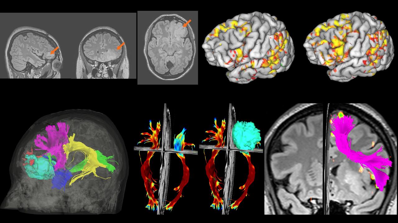 Magnetic_Resonance_Imaging_Fig1