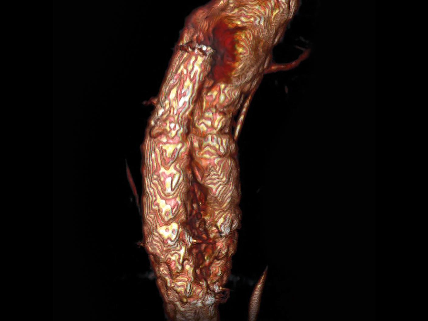 Immediate assessment of treatment results