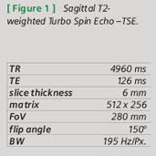 Case Report &quot;MAGNETOM Avanto Recurrent Rectal Cancer Evaluation with VIBE and SPACE&quot;Tab1