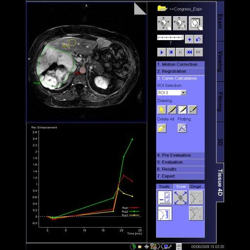 Evaluation of dynamic liver MR examination with Tissue 4D