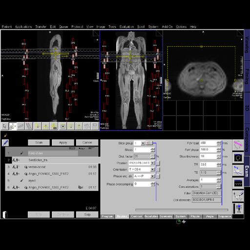 User interface of the Tim Planning Suite for easy planning of extended Field of View examinations