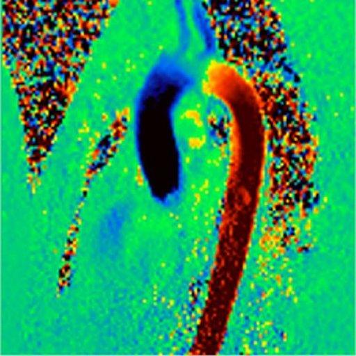 Flow Quantification