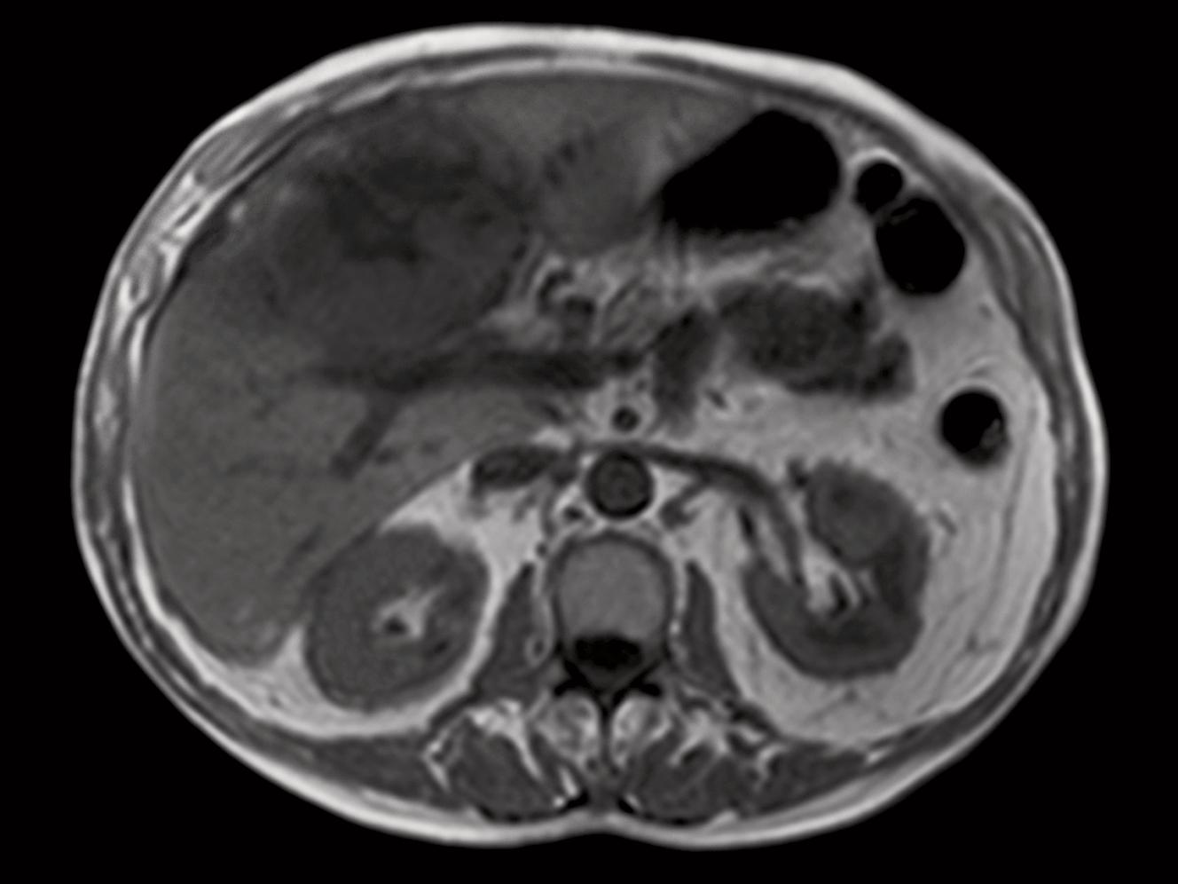 Siemens - MRI - MAGNETOM Aera - Oncology