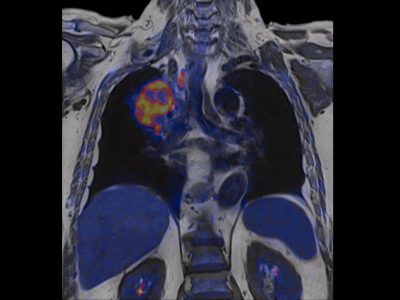 Oncology Imaging