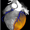 SPECT findings (A)