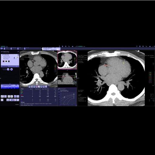 Computed Tomography - Clinical Software Applications - Siemens ...