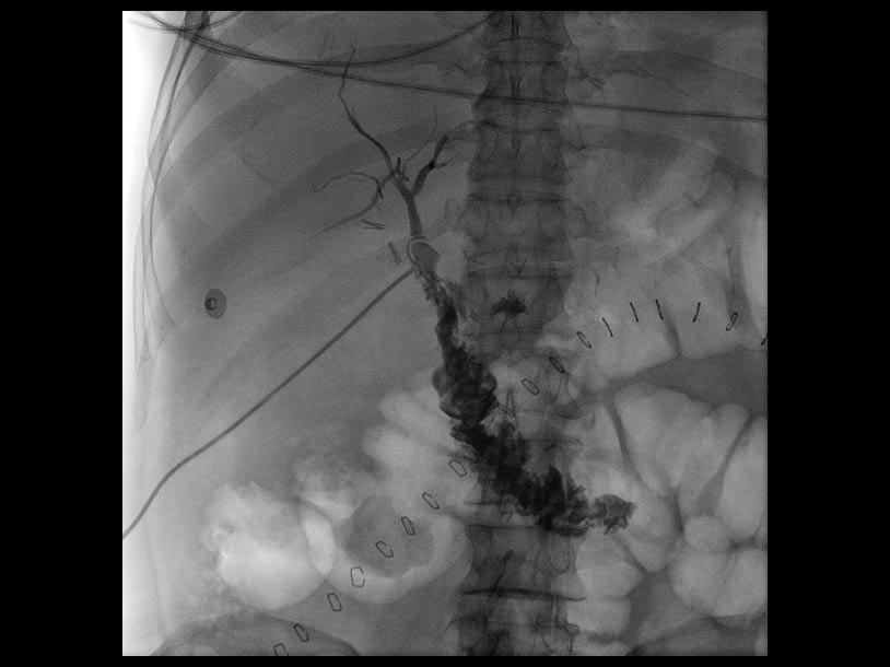 Luminos dRF - Sistema de fluoroscop&iacute;a