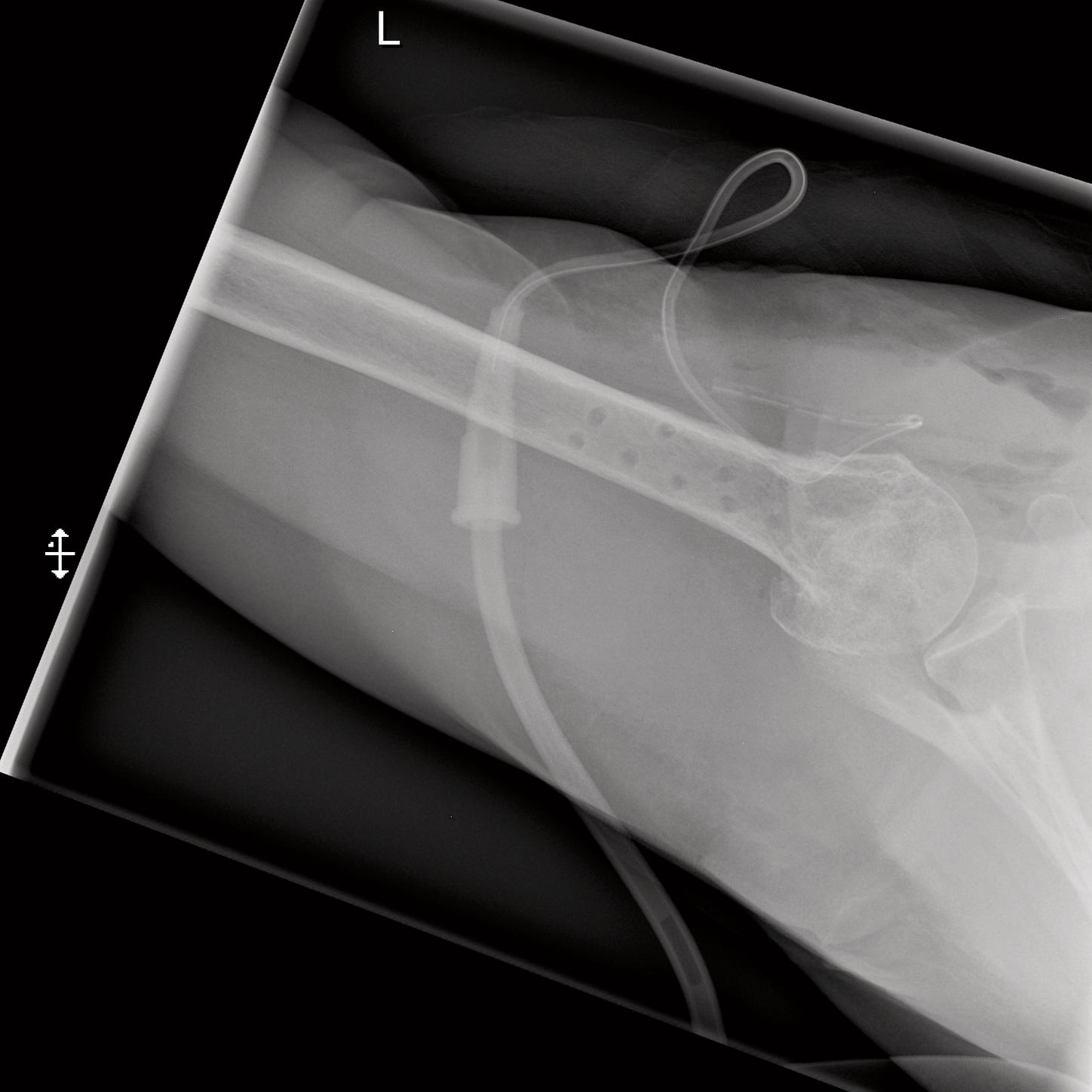 Mira wiD, Shoulder I, axial left