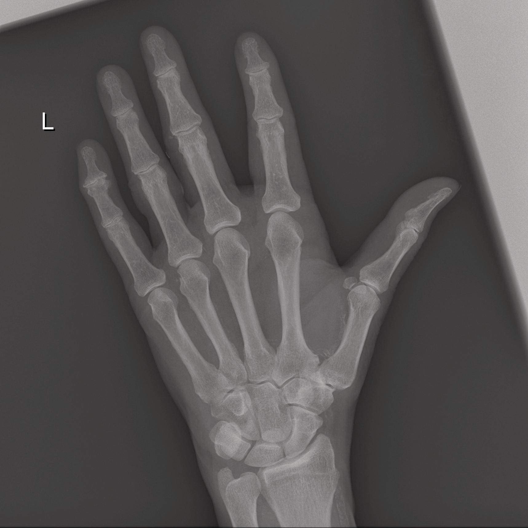 Mira wiD, Hand, ap - Siemens Healthineers Česká republika