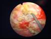 Ursoskop Omnia clinical image