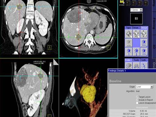 Diagnostics - Siemens Healthineers USA