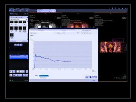 syngo.PET Dynamic Analysis