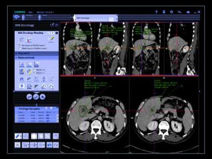 syngo.PET&amp;CT Cross-Timepoint Evaluation