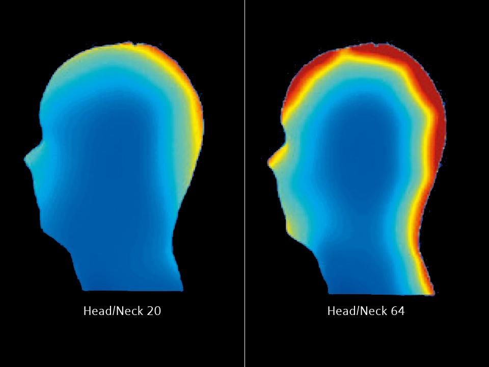 MRI - Coils - Head/Neck 64 - Comparison Head/Neck 20