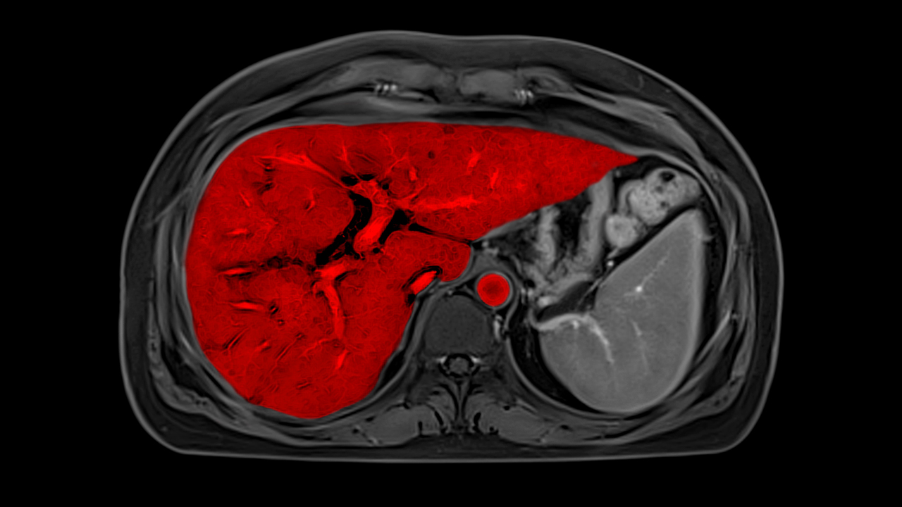 MRI - Clinical Specialities - Body MRI