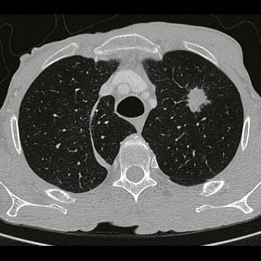 CT Scanner SOMATOM Scope - Siemens Healthineers USA