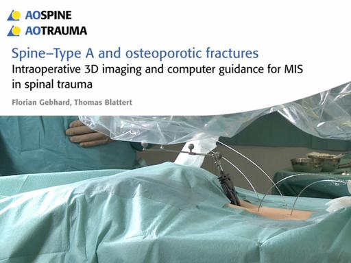 Orthopedic and trauma surgery - Siemens Healthineers Canada