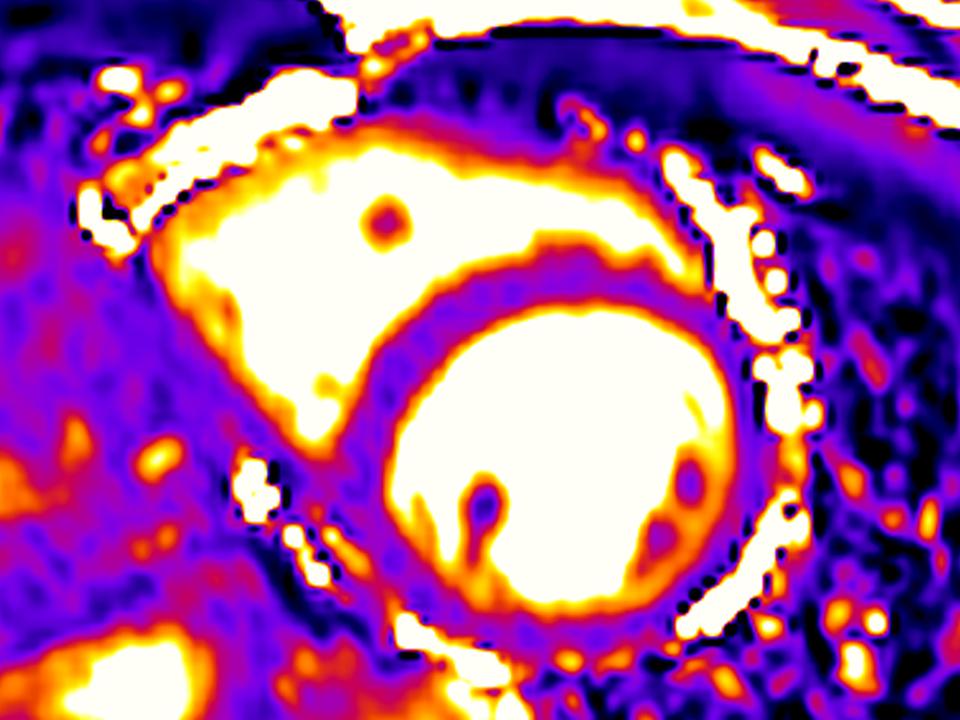 Siemens - MRI - MAGNETOM Amira - Image - Cardiology