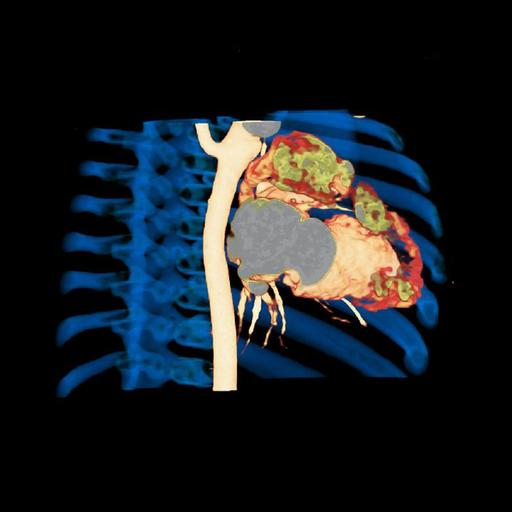 SOMATOM Definition Flash - CT Scanner - Siemens Healthineers Vietnam
