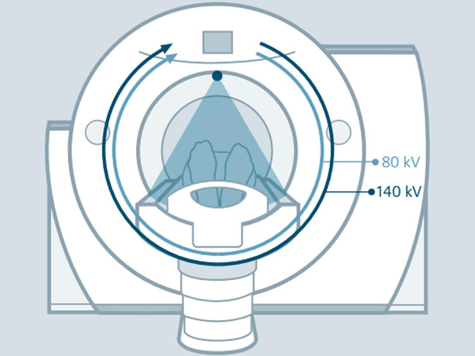 SOMATOM Definition AS Open - Promising new capabilities